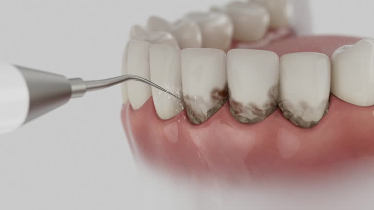 Reliable Emergency Dentist contractor in Roselle, IL by Smile Center Dentistry